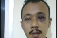 Muhammad Faisal korban pengeroyokan membuat keterangan palsu (video klarifikasi @kabarnegri)